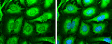 Anti-SOS1 antibody used in Immunocytochemistry/ Immunofluorescence (ICC/IF). GTX133774