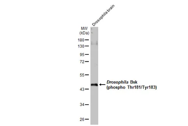 Anti-JNK (phospho Thr183/Tyr185) antibody used in Western Blot (WB). GTX133934