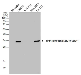 Anti-RPS6 (phospho Ser240/Ser244) antibody used in Western Blot (WB). GTX133942