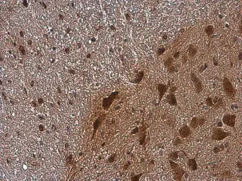 Anti-CGRP antibody used in IHC (Paraffin sections) (IHC-P). GTX134005