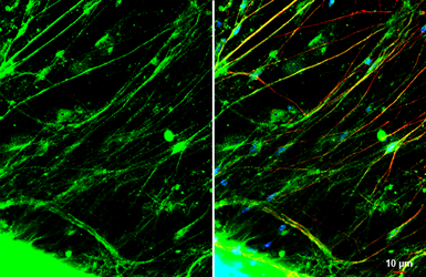 Anti-CGRP antibody used in Immunocytochemistry/ Immunofluorescence (ICC/IF). GTX134005