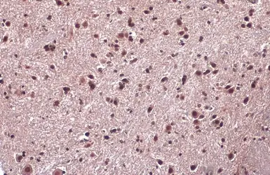 Anti-EN1 antibody used in IHC (Paraffin sections) (IHC-P). GTX134013