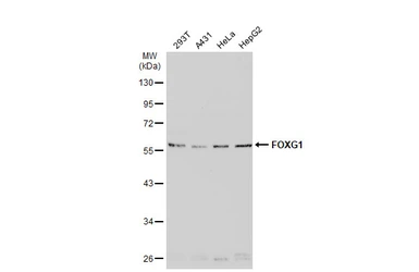 Anti-FOXG1 antibody used in Western Blot (WB). GTX134018