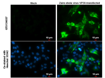 Anti-Ebola virus VP30 antibody used in Immunocytochemistry/ Immunofluorescence (ICC/IF). GTX134037