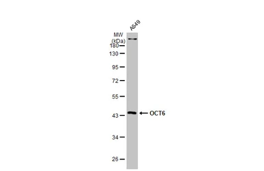Anti-OCT6 antibody used in Western Blot (WB). GTX134063
