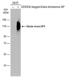 Anti-Ebola virus GP1 antibody used in Western Blot (WB). GTX134144