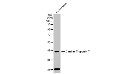 Anti-Cardiac Troponin T antibody used in Western Blot (WB). GTX134489