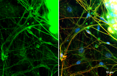 Anti-Nav1.7 antibody used in Immunocytochemistry/ Immunofluorescence (ICC/IF). GTX134494