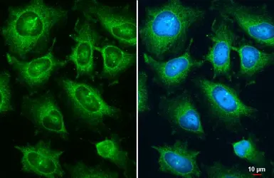 Anti-Ajuba antibody used in Immunocytochemistry/ Immunofluorescence (ICC/IF). GTX134670