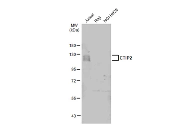 Anti-CTIP2 antibody used in Western Blot (WB). GTX134767