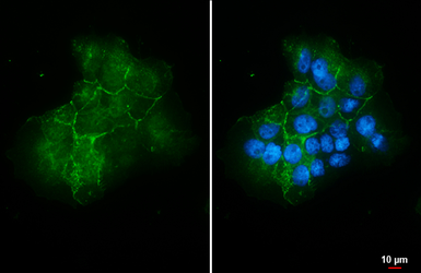 Anti-Claudin 1 antibody used in Immunocytochemistry/ Immunofluorescence (ICC/IF). GTX134842