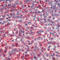 Anti-Calnexin antibody used in Immunohistochemistry (IHC). GTX13504