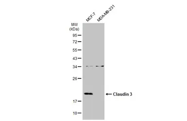 Anti-Claudin 3 antibody used in Western Blot (WB). GTX135322