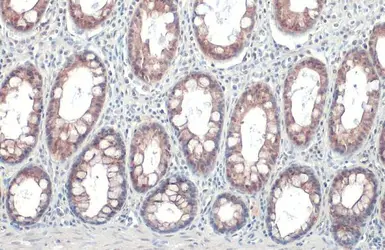 Anti-Claudin 3 antibody used in IHC (Paraffin sections) (IHC-P). GTX135322