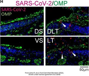 Anti-SARS-CoV-2 (COVID-19) Nucleocapsid antibody used in IHC (Paraffin sections) (IHC-P). GTX135357