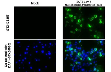 Anti-SARS-CoV-2 (COVID-19) Nucleocapsid antibody used in IHC-P (cell pellet) (IHC-P (cell pellet)). GTX135357