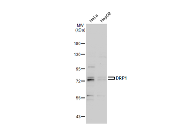 Anti-DRP1 antibody used in Western Blot (WB). GTX135364