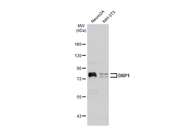 Anti-DRP1 antibody used in Western Blot (WB). GTX135364