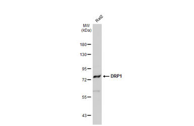 Anti-DRP1 antibody used in Western Blot (WB). GTX135364