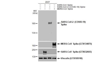 covid spike antibody test results range 250