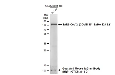 Anti-SARS-CoV-2 (COVID-19) Spike S2 / S2' antibody used in Western Blot (WB). GTX135386