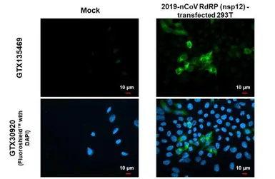 Anti-SARS-CoV-2 (COVID-19) nsp12 antibody used in Immunocytochemistry/ Immunofluorescence (ICC/IF). GTX135469