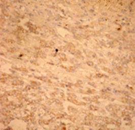 Anti-Fas antibody used in Immunohistochemistry (IHC). GTX13550