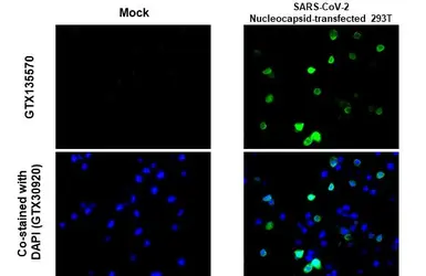 Anti-SARS-CoV-2 (COVID-19) Nucleocapsid antibody used in IHC-P (cell pellet) (IHC-P (cell pellet)). GTX135570