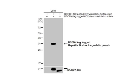 Anti-Hepatitis D virus Large delta protein antibody used in Western Blot (WB). GTX135574