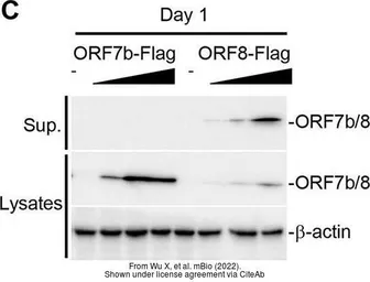 Anti-SARS-CoV-2 (COVID-19) ORF8 antibody used in Western Blot (WB). GTX135591