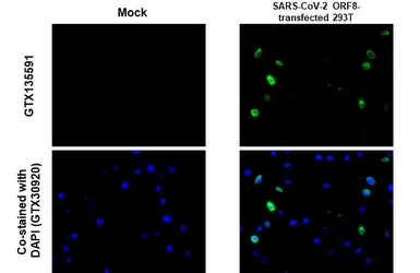 Anti-SARS-CoV-2 (COVID-19) ORF8 antibody used in IHC-P (cell pellet) (IHC-P (cell pellet)). GTX135591