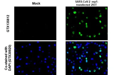 Anti-SARS-CoV-2 (COVID-19) nsp1 antibody used in IHC-P (cell pellet) (IHC-P (cell pellet)). GTX135612