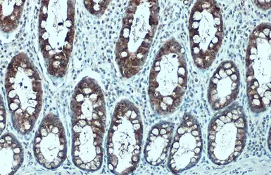 Anti-Mucin 4 antibody used in IHC (Paraffin sections) (IHC-P). GTX135631