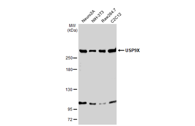 Anti-USP9X antibody used in Western Blot (WB). GTX135634