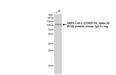 SARS-CoV-2 (COVID-19) Spike S2 (ECD) protein, mouse IgG Fc tag. GTX135684-pro