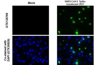 Anti-SARS-CoV-2 (COVID-19) Spike RBD antibody used in IHC-P (cell pellet) (IHC-P (cell pellet)). GTX135709