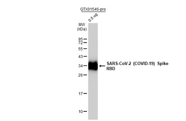 Anti-SARS-CoV-2 (COVID-19) Spike RBD antibody used in Western Blot (WB). GTX135709