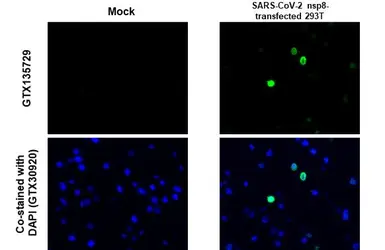 Anti-SARS-CoV-2 (COVID-19) nsp8 antibody used in IHC-P (cell pellet) (IHC-P (cell pellet)). GTX135729