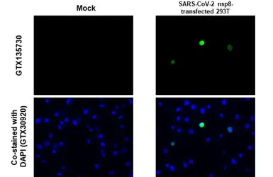 Anti-SARS-CoV-2 (COVID-19) nsp8 antibody used in IHC-P (cell pellet) (IHC-P (cell pellet)). GTX135730