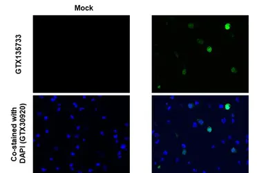 Anti-SARS-CoV-2 (COVID-19) nsp10 antibody used in IHC-P (cell pellet) (IHC-P (cell pellet)). GTX135733