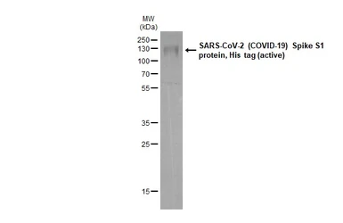 SARS-CoV-2 (COVID-19) Spike S1 protein, His tag (active). GTX135817-pro