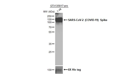 SARS-CoV-2 (COVID-19) Spike S1 protein, His tag (active). GTX135817-pro