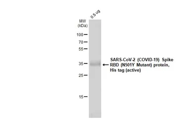 SARS-CoV-2 (COVID-19) Spike RBD Protein, B.1.1.7 / Alpha variant, His tag (active). GTX136014-pro