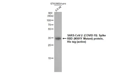 SARS-CoV-2 (COVID-19) Spike RBD Protein, B.1.1.7 / Alpha variant, His tag (active). GTX136014-pro