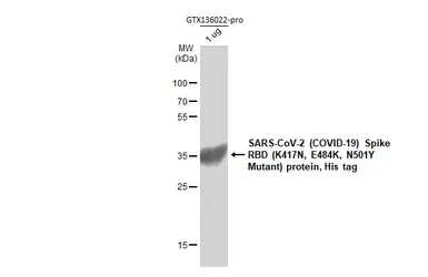 SARS-CoV-2 (COVID-19) Spike RBD Protein, B.1.351 / Beta variant, His tag (active). GTX136022-pro