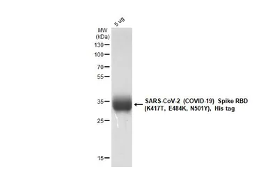 SARS-CoV-2 (COVID-19) Spike RBD Protein, P.1 / Gamma variant, His tag (active). GTX136043-pro