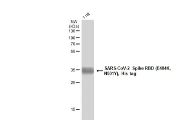 SARS-CoV-2 (COVID-19) Spike RBD Protein, B.1.1.7 with E484K, His tag (active). GTX136058-pro