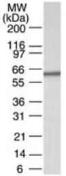 Anti-CARM1 antibody used in Western Blot (WB). GTX13707