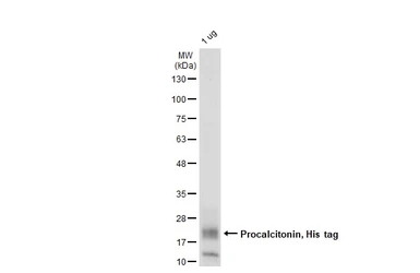 Human Procalcitonin, His tag. GTX138116-pro