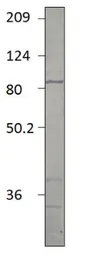 Anti-PDE2A antibody used in Western Blot (WB). GTX14605